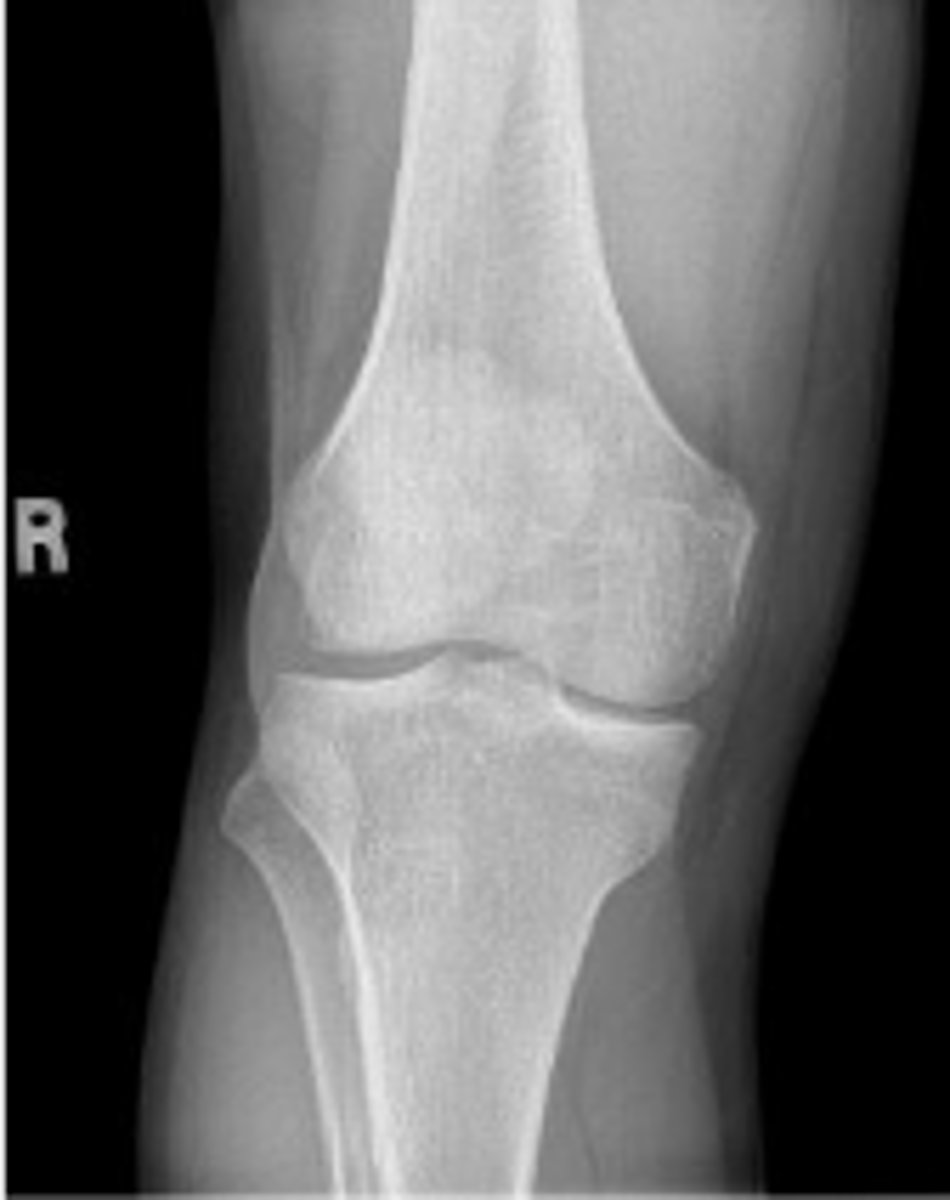 <p>What is the name of the radiographic view?</p>