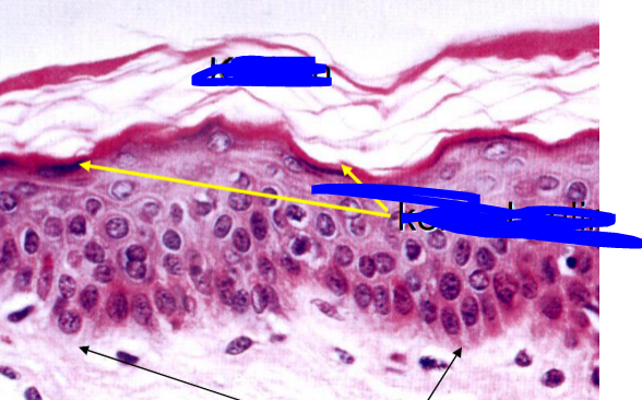 <p>what is this epithelial tissue </p>