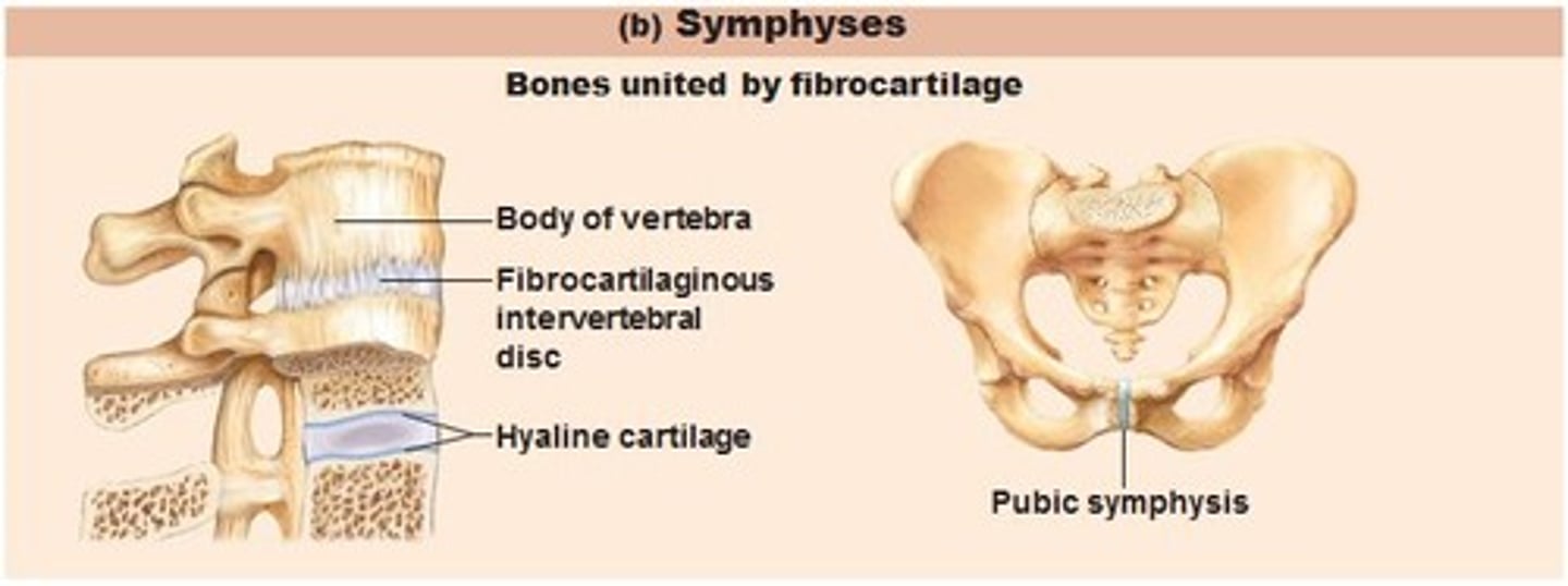 <p>bones are articulates by a disk of fibrocartilage and allow slight movement<br>Ex: pubic symphysis, intervertebral disks</p>