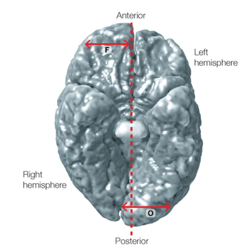 <p>• left and right hemispheres are <strong>offset</strong>: right protrudes (→ bulks out) in the front, left in the back</p>
<p>• cortical area at center of Wernicke’s area (→ <strong>planum temporale</strong>) might be larger in left compared to right hemisphere (in 65% of cases)</p>