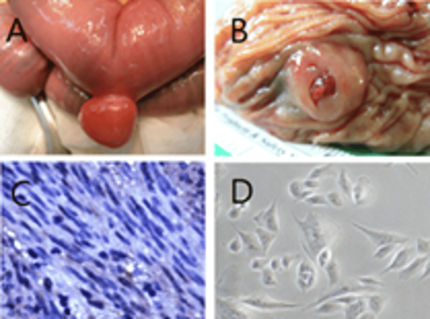 <p>1. EUS with fine-needle aspiration (FNA) biopsy</p><p>2.) CT Abdomen/Pelvis with contrast</p><p>3.) Since the tumor is greater then 2cm it should be surgically removed</p>