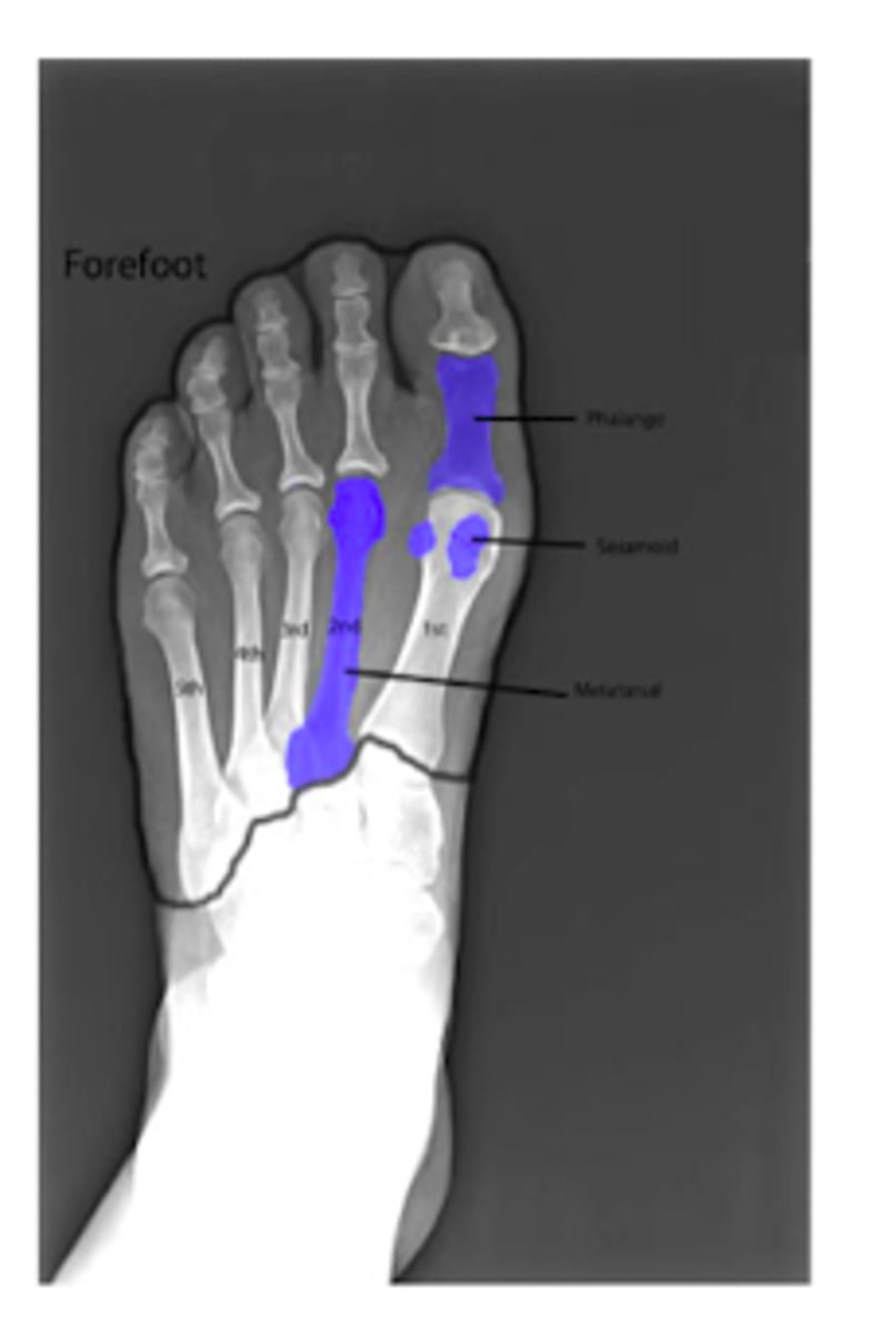 <p>Phalanges</p><p>Metatarsals</p>
