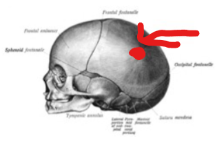 <p>Which parietal bone marking is this? (2)</p>