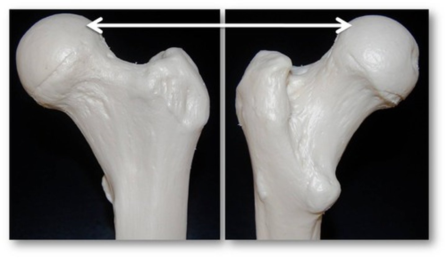 <p>Name this specific part of the femur.</p>