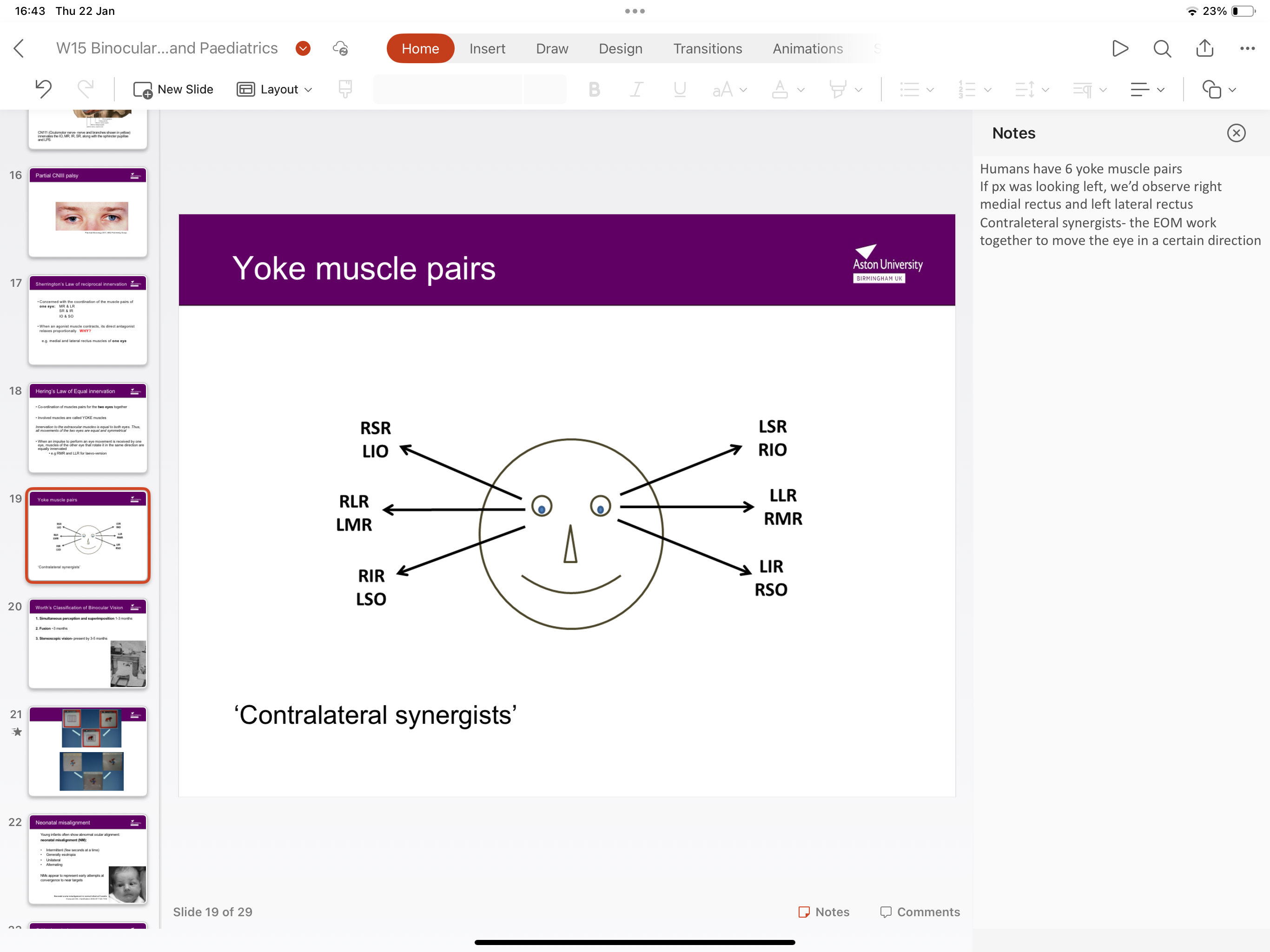 <ul><li><p>LSR - RIO</p></li><li><p>LLR - RMR</p></li><li><p>LIR - RSO</p></li><li><p>RIR - LSO</p></li><li><p>RLR - LMR</p></li><li><p>RSR - LIO</p></li></ul><p></p>