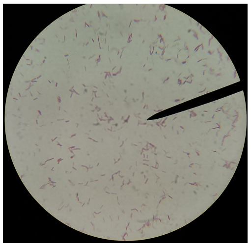 <p>What stain is this?</p>