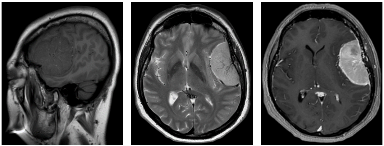 <p>what does this MRI image show, and what phases are each of these?</p>