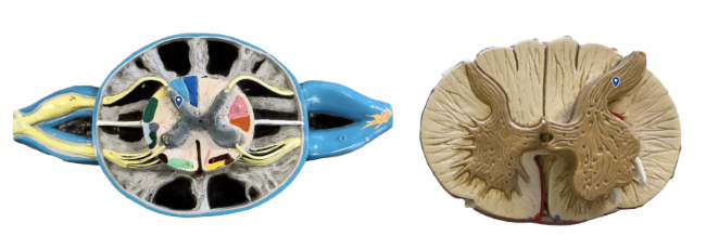 <p>What area of gray matter is the arrow pointing to?</p>