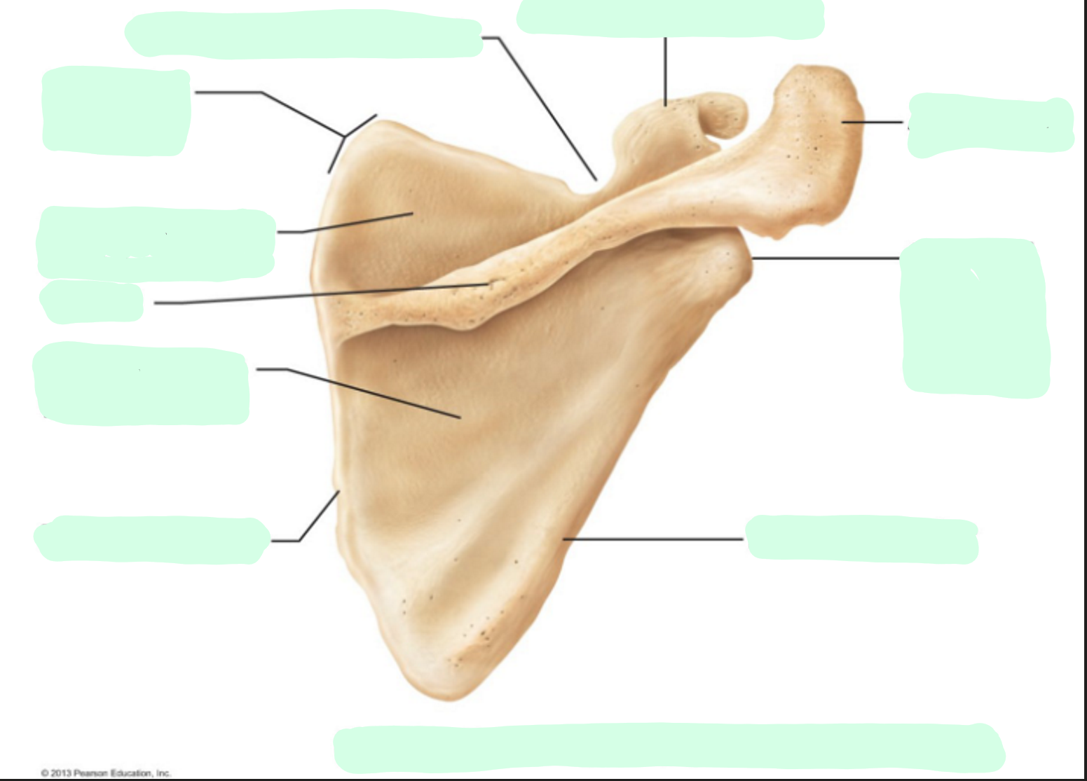 <p>Where is the <strong>infraspinous fossa</strong> of the scapula</p>