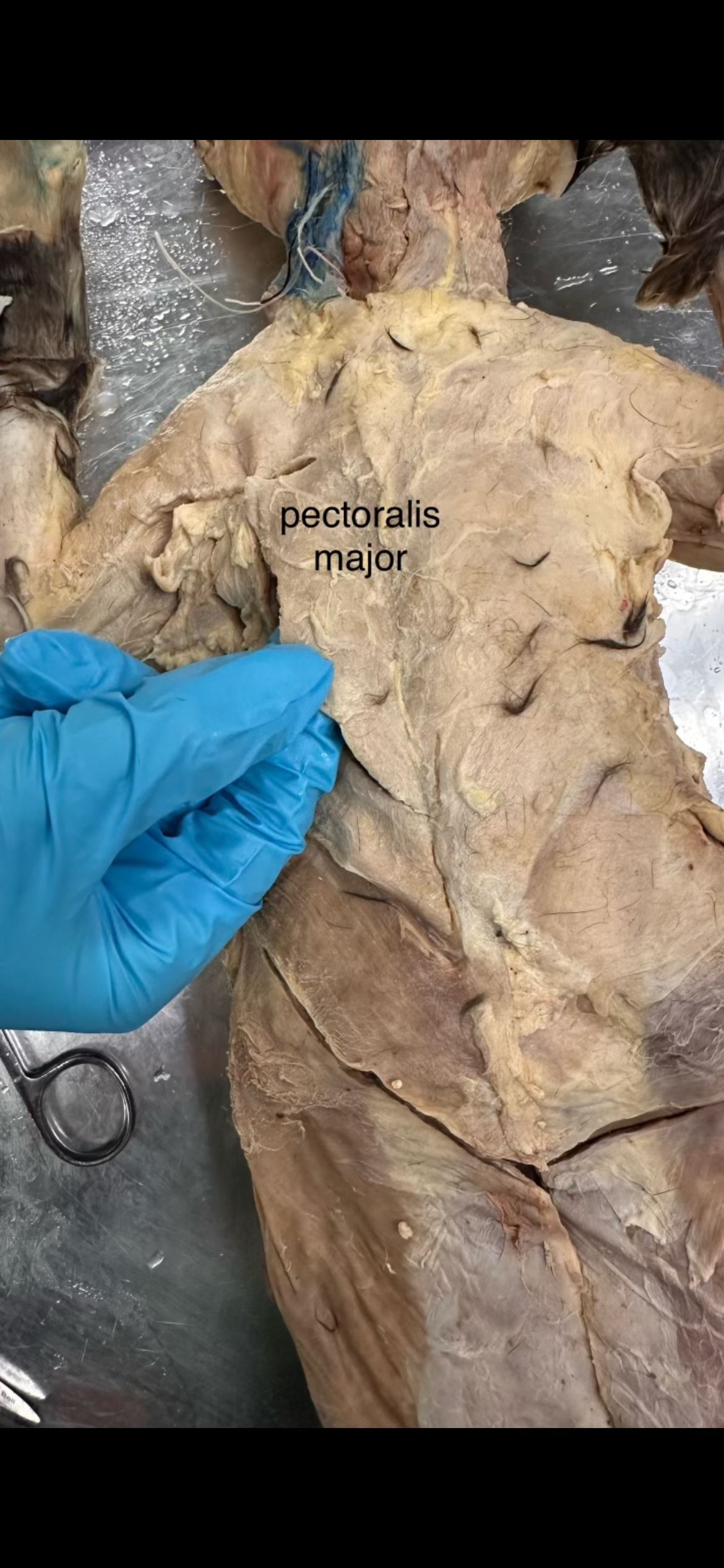 <p>shorter one on top of minor </p>