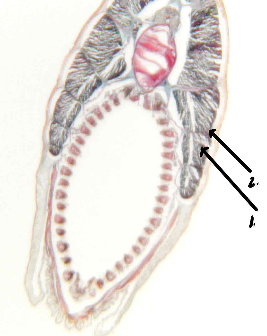 term image