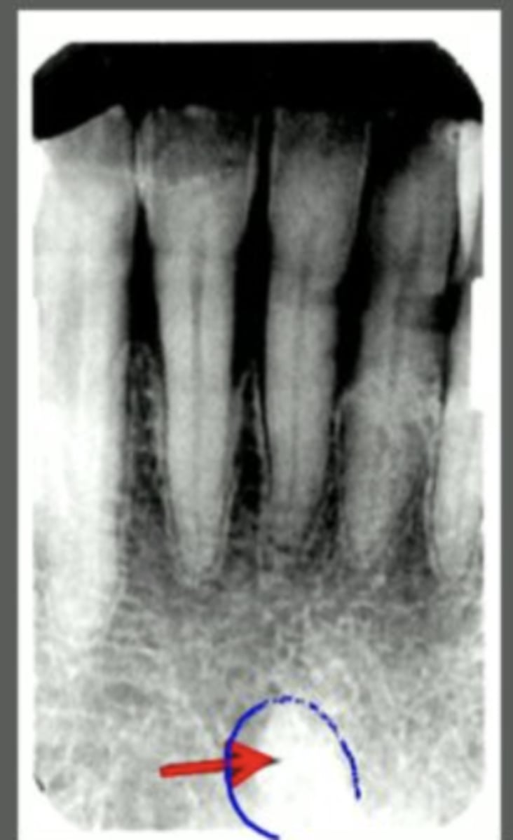 knowt flashcard image