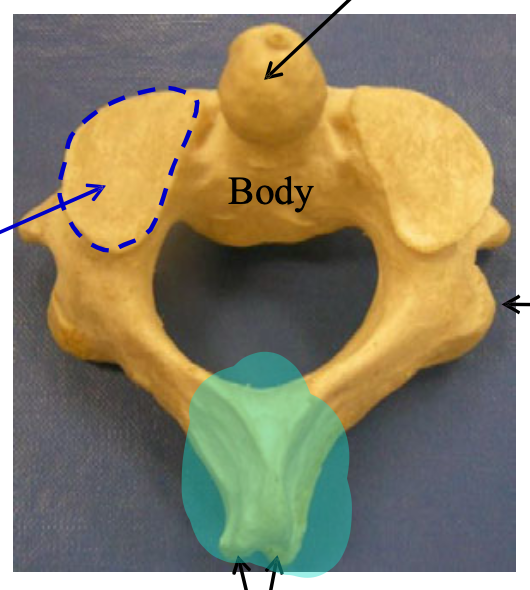 <p>Name the feature of the highlighted structure that distinguishes its vertebrae group</p>
