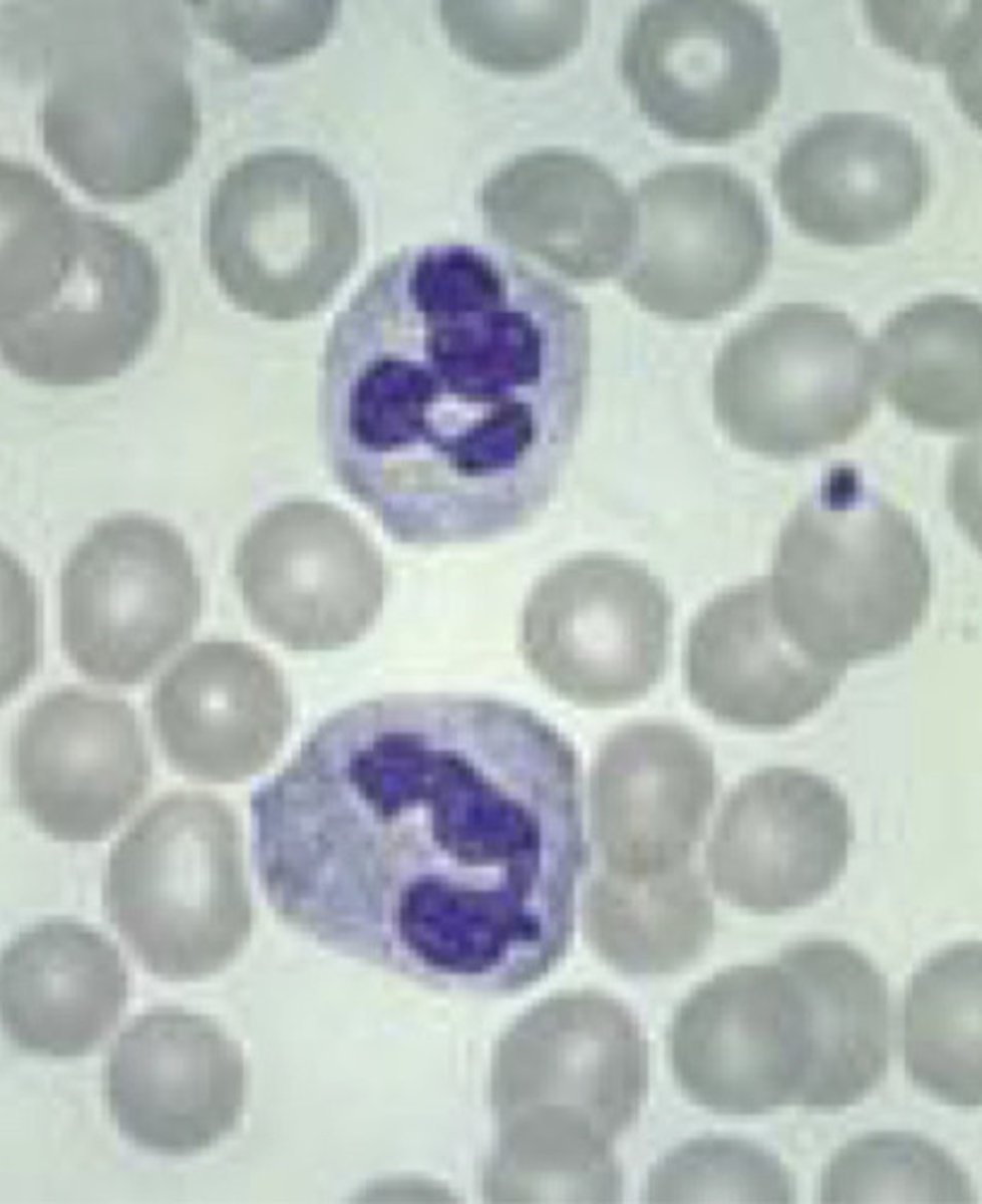 <p>What type of WBC is seen in this image?</p>