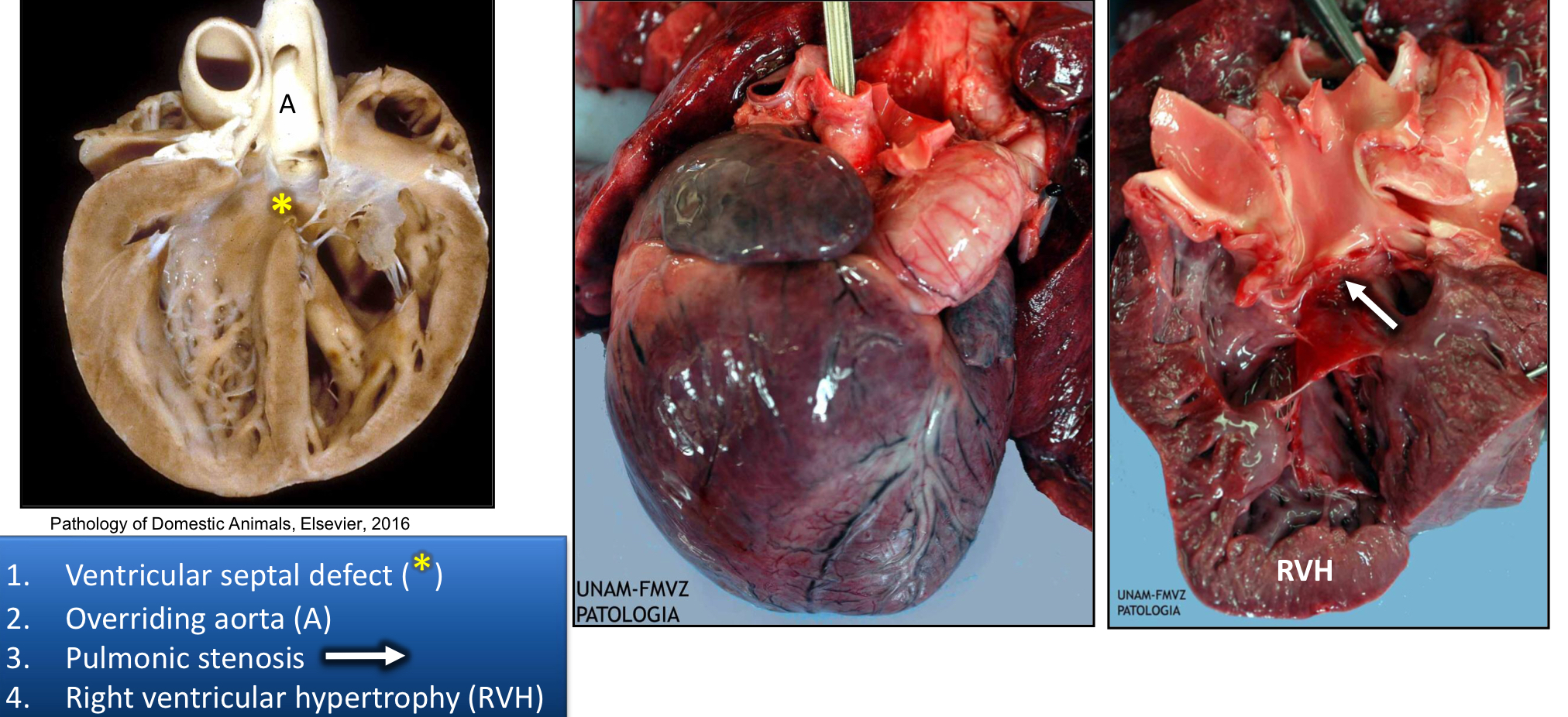 <ol><li><p>Ventricular Septal Defect</p></li><li><p>Overriding Aorta</p></li><li><p>Pulmonic Stenosis</p></li><li><p>Right ventricular Hypertrophy</p></li></ol><p></p>