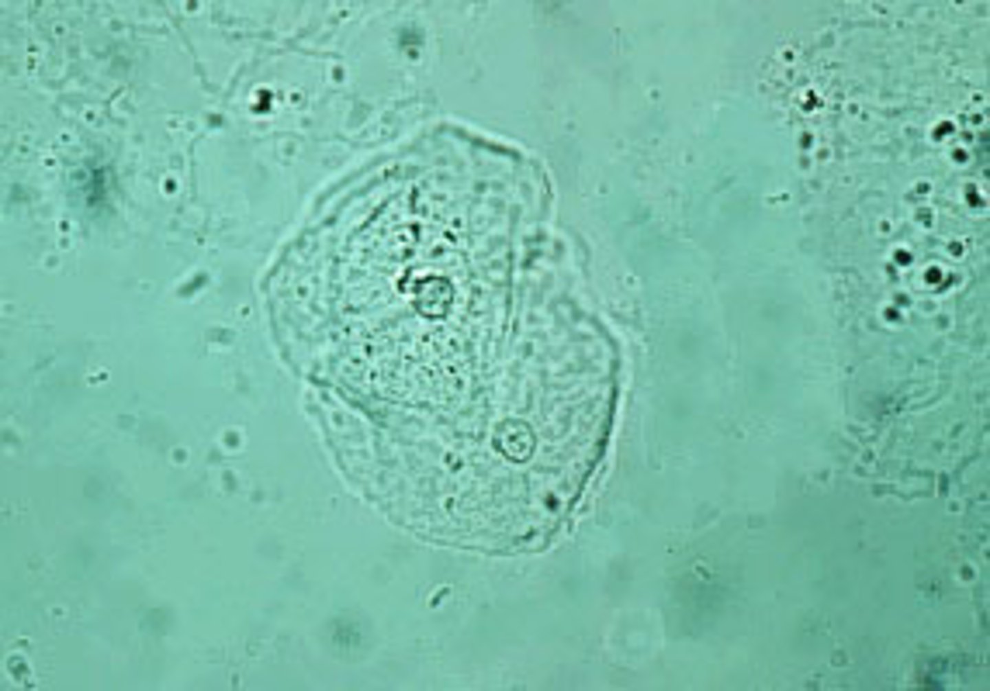 <p>-irregular edging around the cell membrane</p><p>-small nucleus in the center</p><p>-can roll/fold in on itself</p>