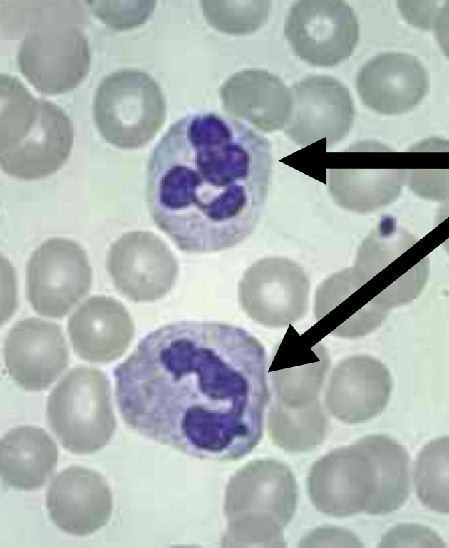 <p>What kind of blood cell is this?</p>