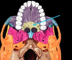 <p>palatine bone</p><img src="https://knowt-user-attachments.s3.amazonaws.com/da3b4eff-0e6c-4945-a35f-2650f0e0965b.jpg" data-width="50%" data-align="center" alt="knowt flashcard image"><p></p>