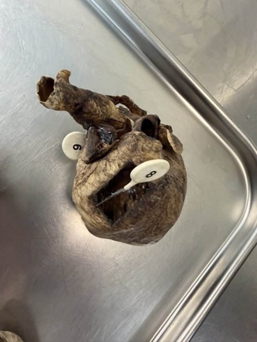 <p>A. ID the chamber of the heart pierced by the pin.</p><p>B. Through which opening did blood enter this space?</p><p>C. Which valve will blood in this chamber pass next?</p>