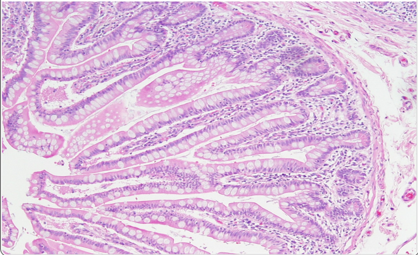 <p>this is in the</p>