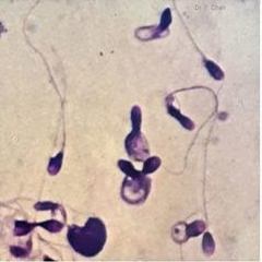 <p>Identify the sperm morphology.</p>