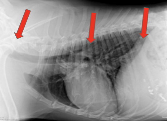 <p>1. thoracic inlet</p><p>2. base of heart</p><p>3. diaphragmatic hiatus</p>