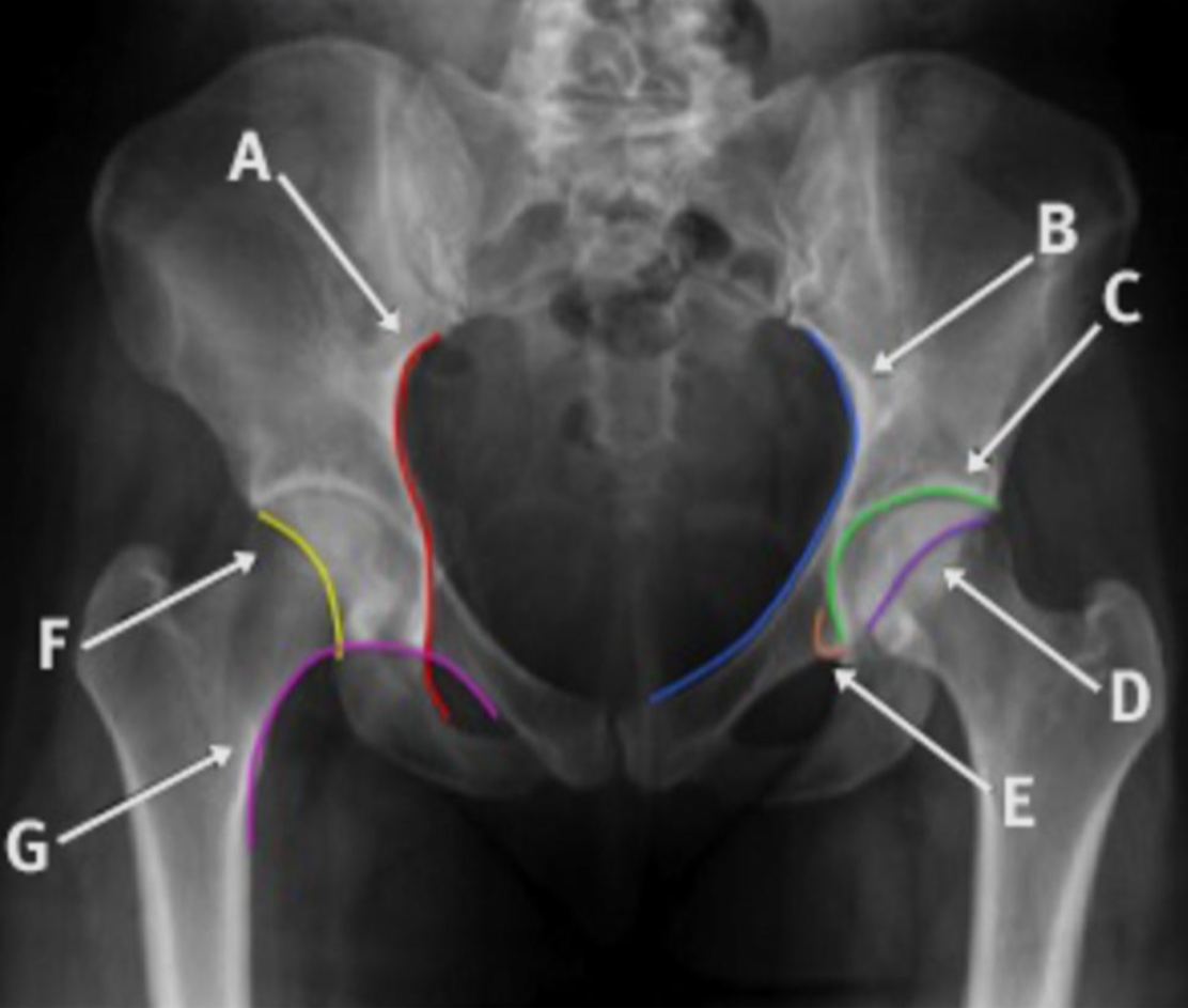 <p>Label the lines</p>