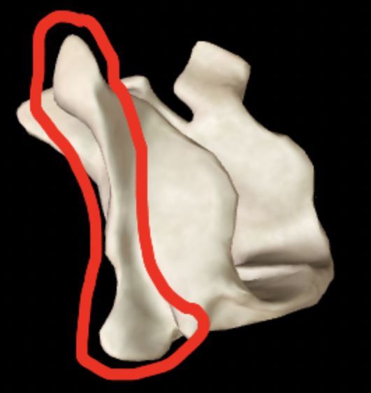 <p>What part of the palatine is this?</p>