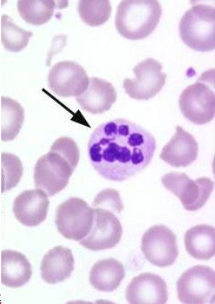 <p>- oval macrocytes <br>- hypersegmented neutrophils <br>- aniso and poikilo-cytosis <br>- RBC inclusions</p>