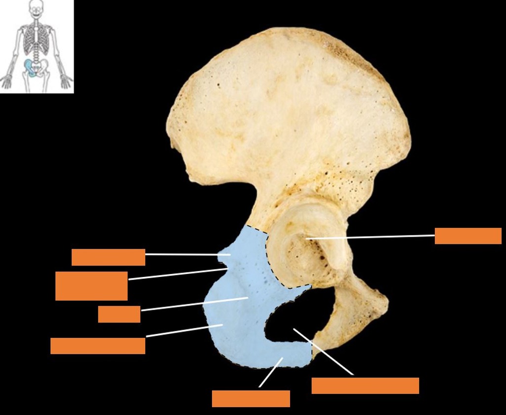 <p>What bone is this?</p>