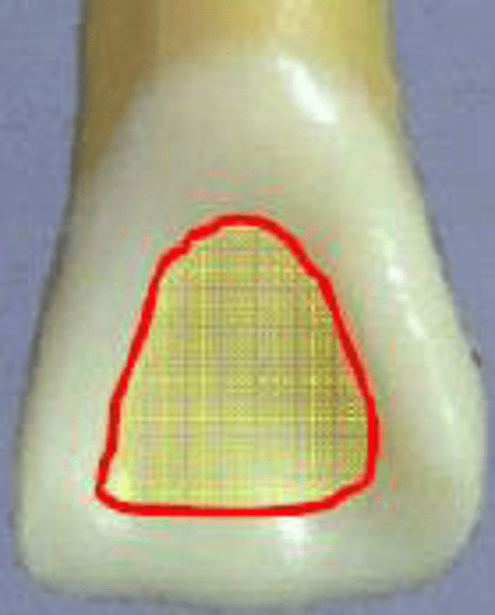<p>what is the shaded area called?</p>