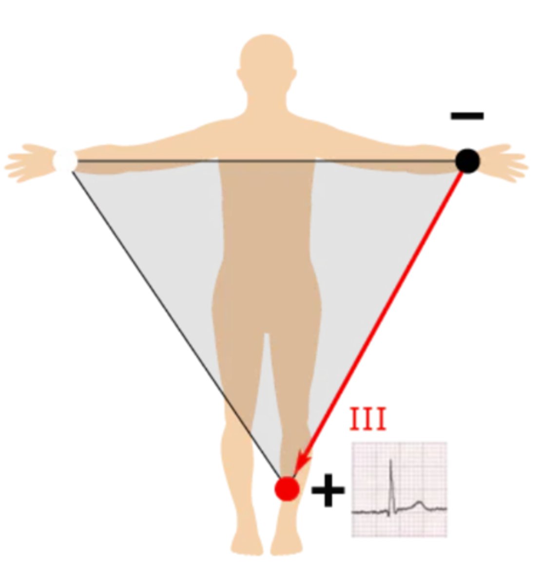 <p>Left arm --> left leg; produces a positive waveform as heart's electrical activity naturally moves down &amp; to the left</p>