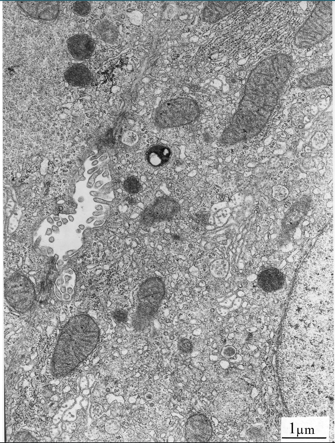 <p>Identify</p><ol><li><p>The cell membrane </p></li><li><p>The nucleus and nuclear envelope </p></li><li><p>Rough and smooth endoplasmic reticulum </p></li><li><p>Ribosomes </p></li><li><p>Golgi apparatus </p></li><li><p>Mitochondria</p></li><li><p>Vesicles </p></li><li><p>Lysosomes </p></li><li><p>Glycogen granules</p></li></ol><p></p><p><em>Add the drawing of these that identify what this is</em></p>