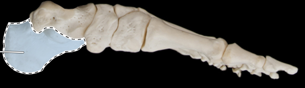 <p>Bones of the foot, medial view</p>