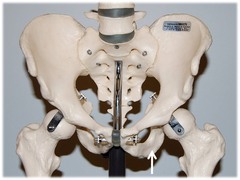 Name this specific region of the pelvic bone.