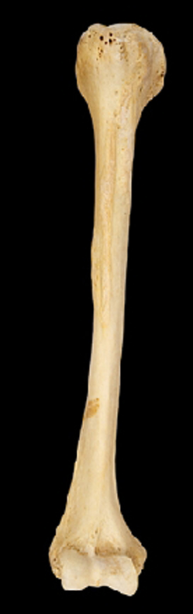<p>What bone is this?</p><p>Left side or right side?</p><p>(Anterior view).</p>