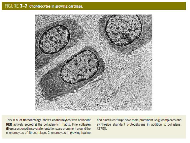 <p>= fibrocartilage</p><ul><li><p>tussenvorm van hyalien kraakbeen &amp; dicht bindweefsel</p></li><li><p>het komt voor in:</p><ul><li><p>tussenwervelschijven</p></li><li><p>aanhechtingen van sommige ligamenten aan bot</p></li><li><p>symphysis pubis</p></li></ul></li><li><p>talrijke dikke collagene vezels type I</p><ul><li><p>hierdoor kan kraakbeen aan grote trekkrachten (trekbelasting) weerstand bieden met behoud van draagvermogen (drukbelasting)</p></li></ul></li><li><p>chondrocyten → morfologisch overeenkomend met die in hyalien kraakbeen</p><ul><li><p>liggen ook vaak in isogene groepen → MAAR: vorm van rijen achtereen gelegen cellen, parallel aan collagene vezels</p></li></ul></li><li><p>matrix: talrijke dikke collagene vezels van type I</p><ul><li><p>lichtmicroscopisch goed waar te nemen</p></li></ul></li><li><p>matrix lijkt voor overige deel op die van hyalien kraakbeen</p></li><li><p>vezelig kraakbeen → geen herkenbaar perichondrium</p></li></ul><p></p>