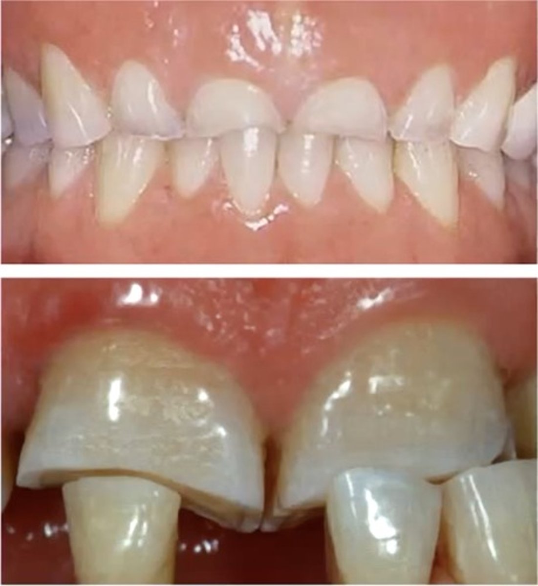 <p>identify the type of differential diagnosis</p>