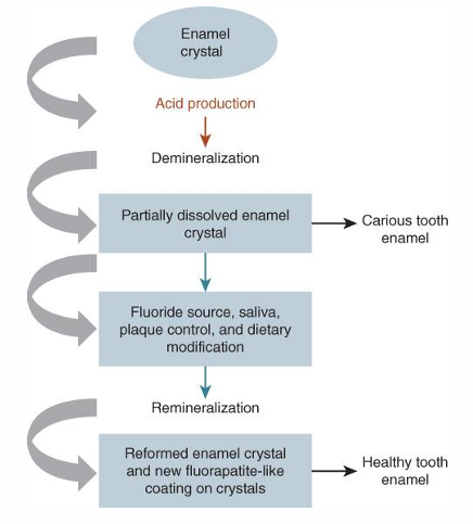 <ol><li><p>crystal enamel</p></li><li><p>acid is produced —&gt; demineralization</p></li><li><p>partially dissolved enamel crystals —→ tooth caries OR</p></li><li><p>fluoride source, saliva, plaque control, and diet mods —→ remineralization</p></li><li><p>reformed enamel crystals and new flourapatite-like coating on crystals </p></li><li><p>healthy tooth enamel</p></li></ol><p></p>