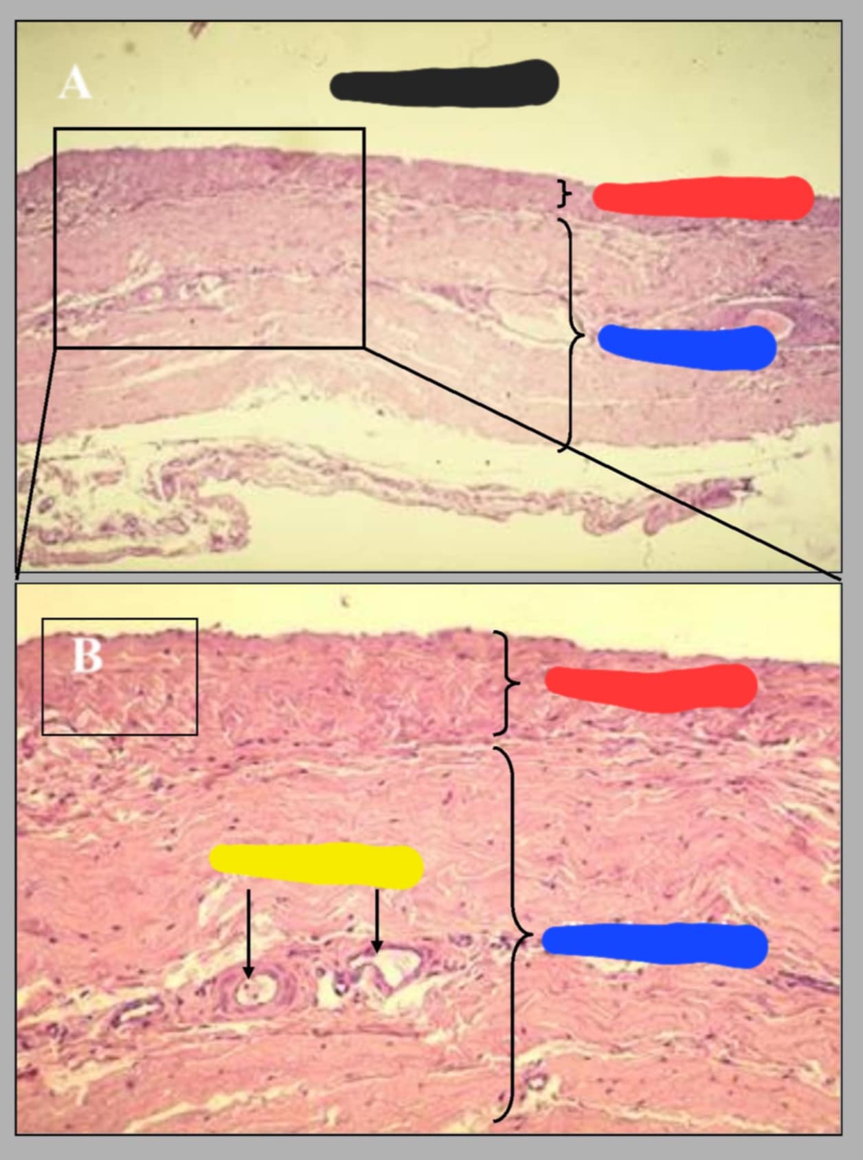<p>name this slide and its parts</p>