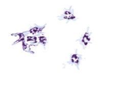 <p>essentially irregularly shaped cell fragments; stain deep purple</p>