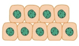 <p>Hyperplasia</p>