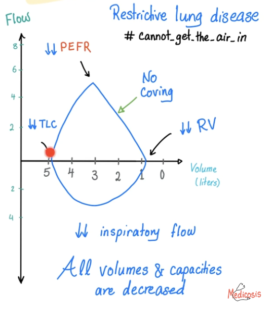 <ul><li><p>Air can’t come in</p></li><li><p>Decreased volumes and capacities</p></li><li><p>Decreased PEFR</p></li><li><p>No coving- Normal expiration</p></li></ul><p></p>