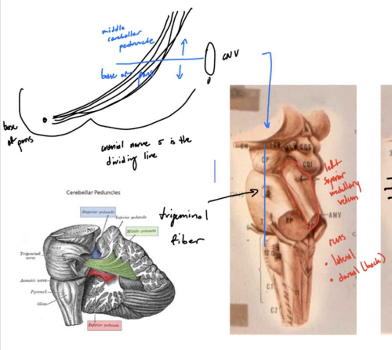 <p>base of pons from middle cerebral peduncle</p><p>ventral -- base of pons</p><p>dorsal -- middle cerebral peduncle</p>