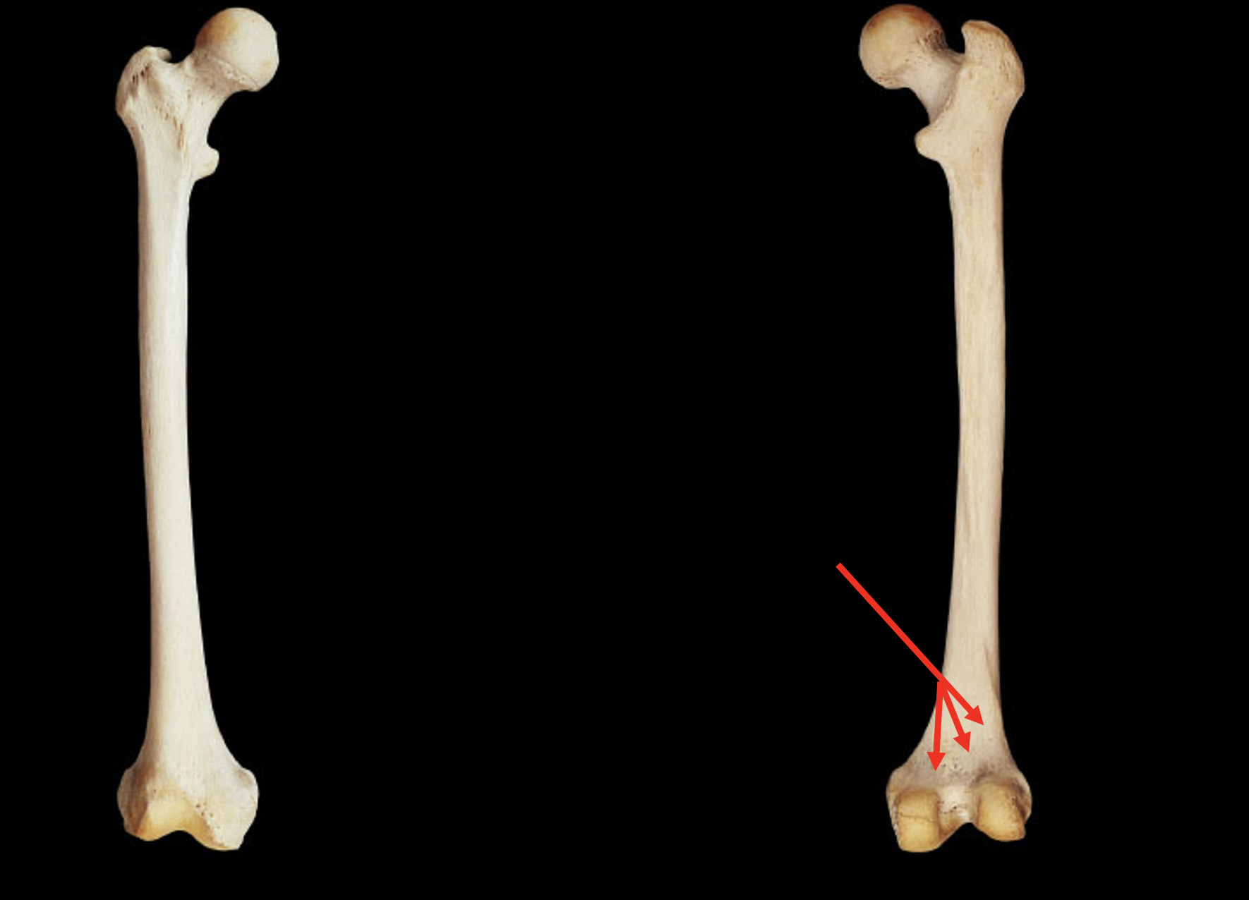 <p>Name this region of the femur</p>