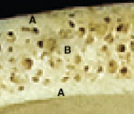 <p>Name points A (short bone).</p>