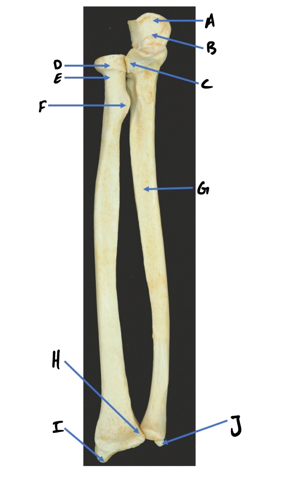 <p>A</p>
