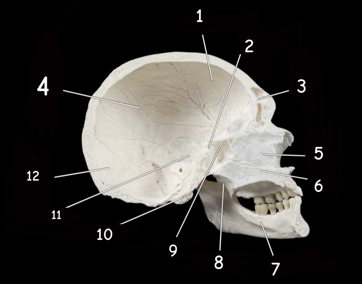 term image