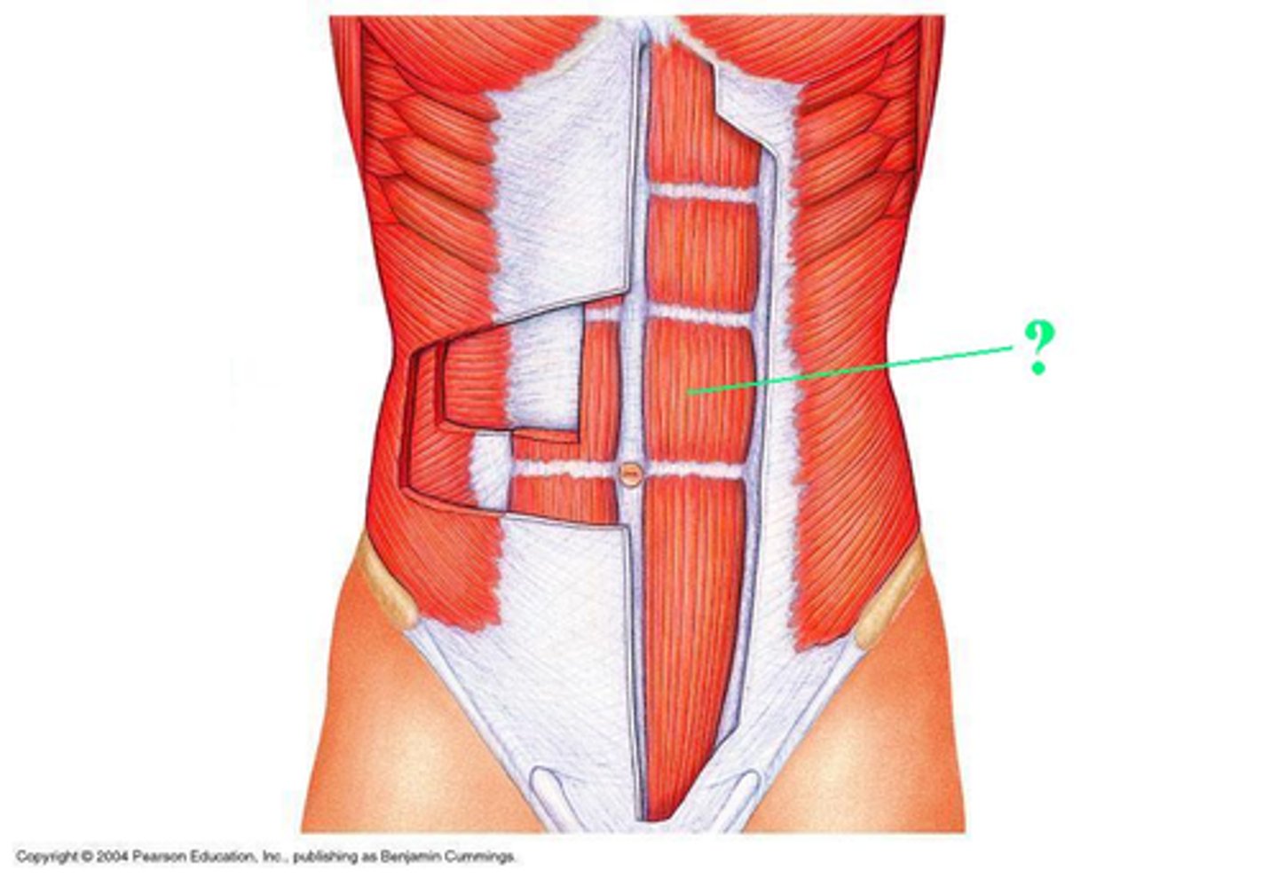 <p>Identify the indicated muscle</p>