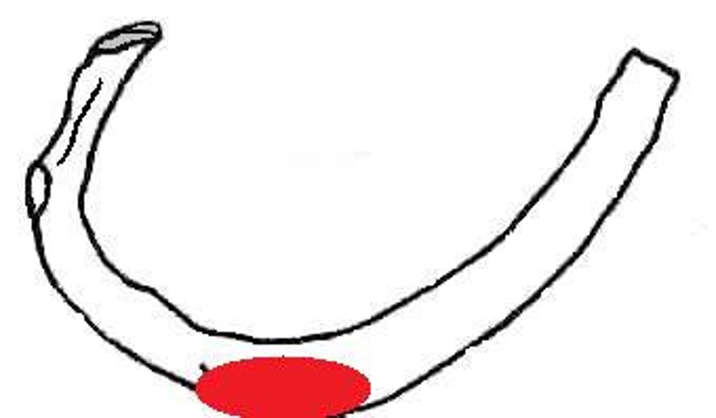 <p>A bulbous bony protrusion found centrally but on the superior anterior facing region of rib of 2nd rib only</p>